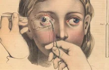 Medyczne ilustracje z XIX wieku