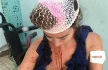 Turystka brutalnie pobita w Chorwacji. Właściciel hostelu zrobił jej coś...