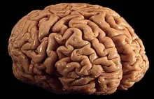 Pierwszy skuteczny lek na Alzheimera ma być za 6 lat | HUMAN_2.0