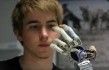 Bioniczna dłoń sterowana umysłem