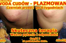 Część 3 - WODA CUDÓW - WODA PLAZMOWANA❗ Czerniak przed i po 6 tygodniach...