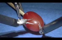 da Vinci Robot Peeling at Grape - Doctors Hospital at White Rock Lake