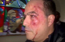 Wenezuela: deputowani dotkliwie pobili się w parlamencie