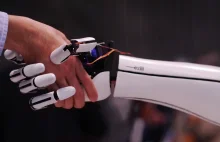 Bioniczna ręka Hackberry może dokonać rewolucji w protetyce