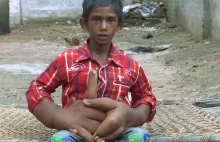 Jedenastolatek z Indii ma bardzo duże dłonie. I wielką nadzieję