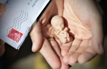Poroniony pomysł szpitala w Opolu: płód jak przesyłka pocztowa?