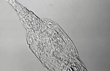Bezpłciowe wrotki z podgromady Bdelloidea wbudowują sobie DNA innych organizmów