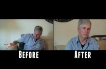 [ANG] Pacjent z chorobą Parkinsona przed i po zażyciu Medycznej Marihuany
