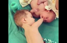 Chłopiec bez rączek troszczy się o swoją nowo narodzoną siostrzyczkę