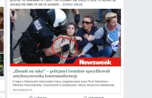 Newsweek: „policja złamała jej rękę”. Katowiczanka: „ależ skąd” -...
