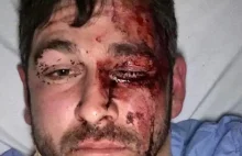Szkocki zawodnik MMA brutalnie pobity w Australii