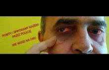 Brutalna interwencja policji - mężczyzna stracił wzrok!