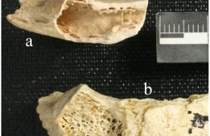 Pomimo że neandertalczycy żyli w nieskażonym środowisku i tak dostawali raka!