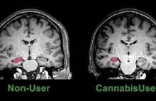Zażywanie marihuany prowadzi do zwiększonej łączności w mózgu
