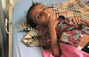 Jemen: Adam ma 10 lat a waży tyle co 12 miesięczne niemowlę