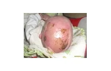WOLSZTYN: Oszpecili dziecko w szpitalu (foto)