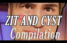 Most disgusting Zits and Cyst- Compilation 2016