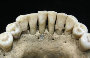 Zakonnica z niebieskimi zębami. Naukowcy rozwiązali średniowieczną zagadkę.