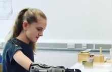 Dziewczynka pierwszy raz używa sztucznego ramienia