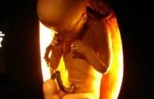 Powiedzcie mi, co się stanie, jeżeli moje dziecko przeżyje aborcję?