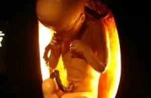 Powiedzcie mi, co się stanie, jeżeli moje dziecko przeżyje aborcję?