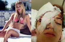 Graphic Video: 15-Year-Old Danish Girl Blinded When Six Moroccan Muslim..(Eng.)