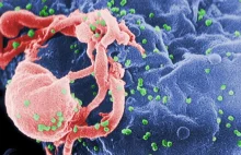 Zmutowany wirus HIV wyleczył ciężkie choroby genetyczne.