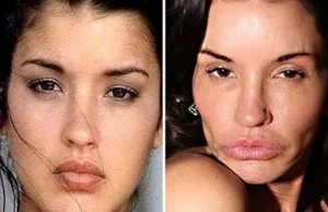 Celebrity Plastic Surgery Nightmares