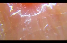 Ludzka skóra pod mikroskopem | Human skin under microscope MIKROŚWIAT...