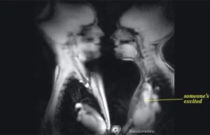 Seks w rezonansie magnetycznym - Crazy Nauka