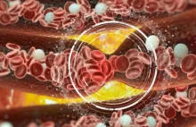 Przełom w leczeniu zawałów i udarów - nanokapsułki rozpuszczą skrzep