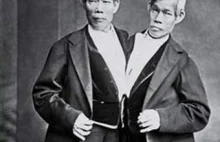 Nierozłączni bracia – niezwykła historia Changa i Enga Bunkerów