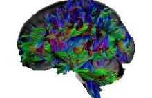 "Okablowanie" mózgu u ludzi z ponadprzeciętna wiedzą jest szczegolnie efektywne.