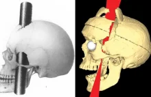 Przypadek Phineasa Gage’a czyli człowiek z dziurą w głowie