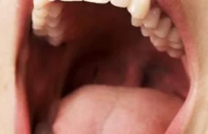 Koniec świata dentystów - rewolucja w stomatologii.