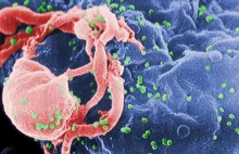 Wirusy HIV łagodnieją - twierdzą naukowcy