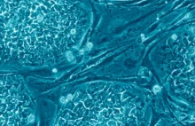 Toksyczne komórki macierzyste zabijają raka