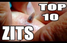 TOP 10 ZITS - INCREDIBLE FLYING PIMPLES