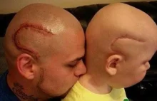 ojciec robi sobie tatuaż aby wesprzeć syna po operacji guza mózgu [NL]