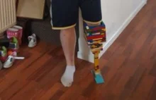 Zrobił sobie protezę nogi z... klocków Lego