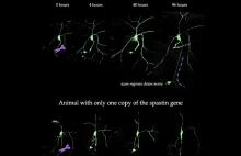 Naukowcy zidentyfikowali gen odpowiedzialny za regenerację nerwów.