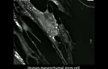 Komórka macierzysta przekształca się w neuron.
