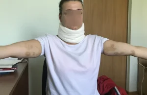 36-latka oskarża raciborskich policjantów o pobicie.