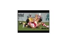 Najgorsze złamanie na meczu rugby