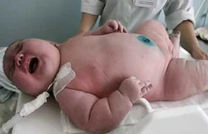 270 kilogramowa kobieta przyjeżdża w nocy do szpitala. Rodzi chłopca,...