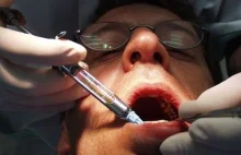 Jak oszukują stomatolodzy.