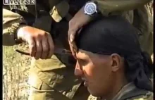 Russian soldier has bullet removed from forehead with pair of pliers (2000