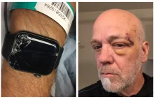 Apple Watch uratował go przed śmiercią. Smartwatch wykrył upadek i wezwał pomoc.