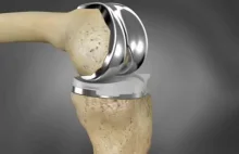 Nowy rodzaj stopu pozwoli na stworzenie znacznie wytrzymalszych implantów