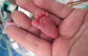 Emilia Grabarczyk najmniejszym noworodkiem świata